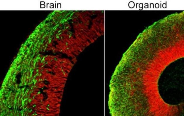 Учёные выращивают человеческий мозг, способный в перспективе думать и чувствовать