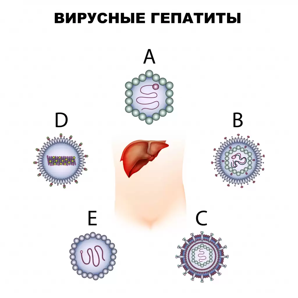 заболел гепатитом